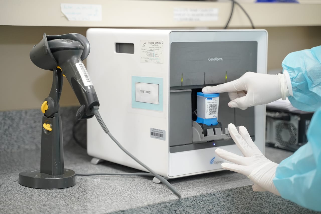 Profissional do Lacen-GO realiza testes moleculares: ação preventiva ajuda no controle da doença, que pode gerar complicações pulmonares e infecção generalizada. Foto: SES-GO