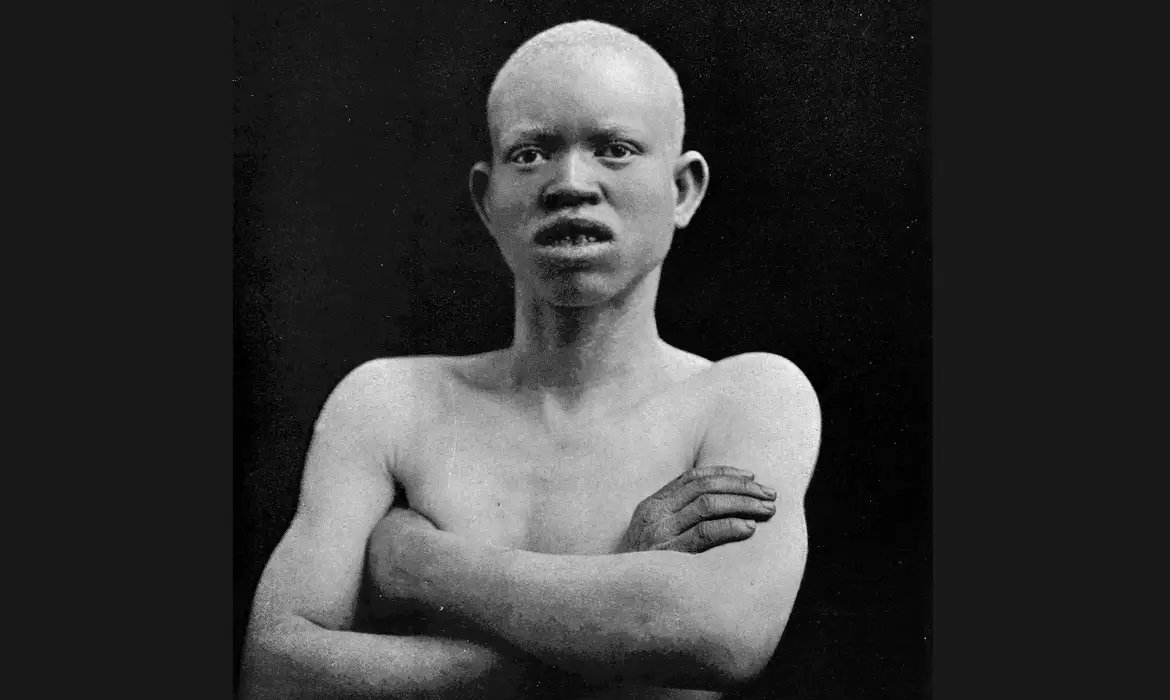 Foto: © @wellcome.ac.uk/WikImedia Commons
