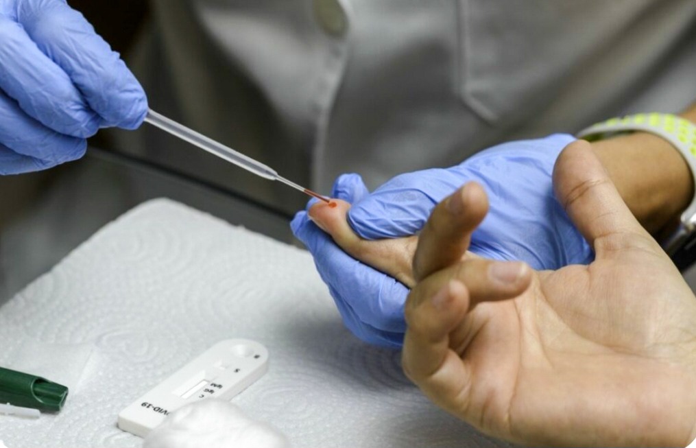 Goiânia registra queda de 10% nos casos de HIV em 2024. Foto: Divulgação