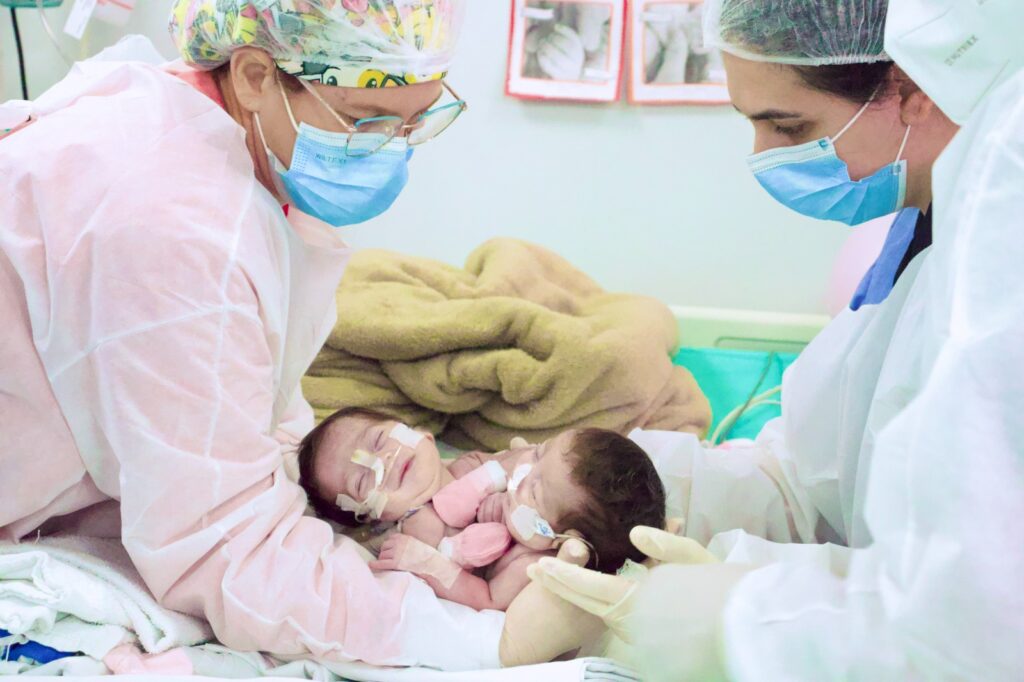 Termina a cirurgia de separação das gêmeas Eliza e Yasmin