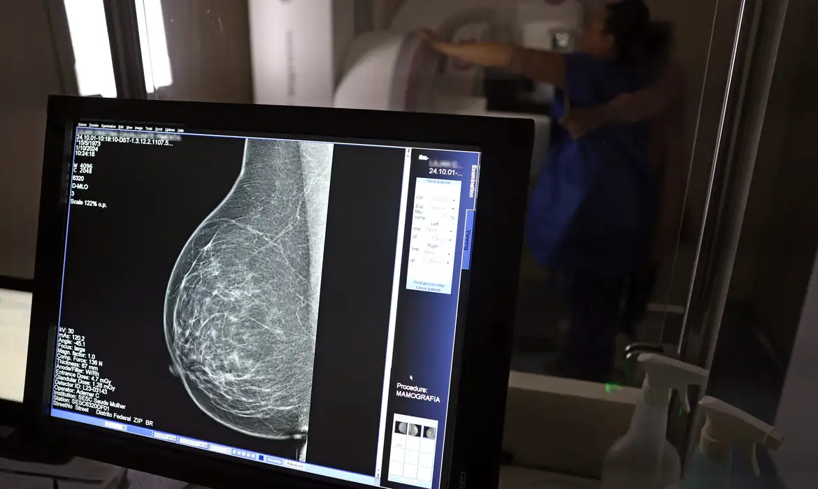 Saúde mamografia