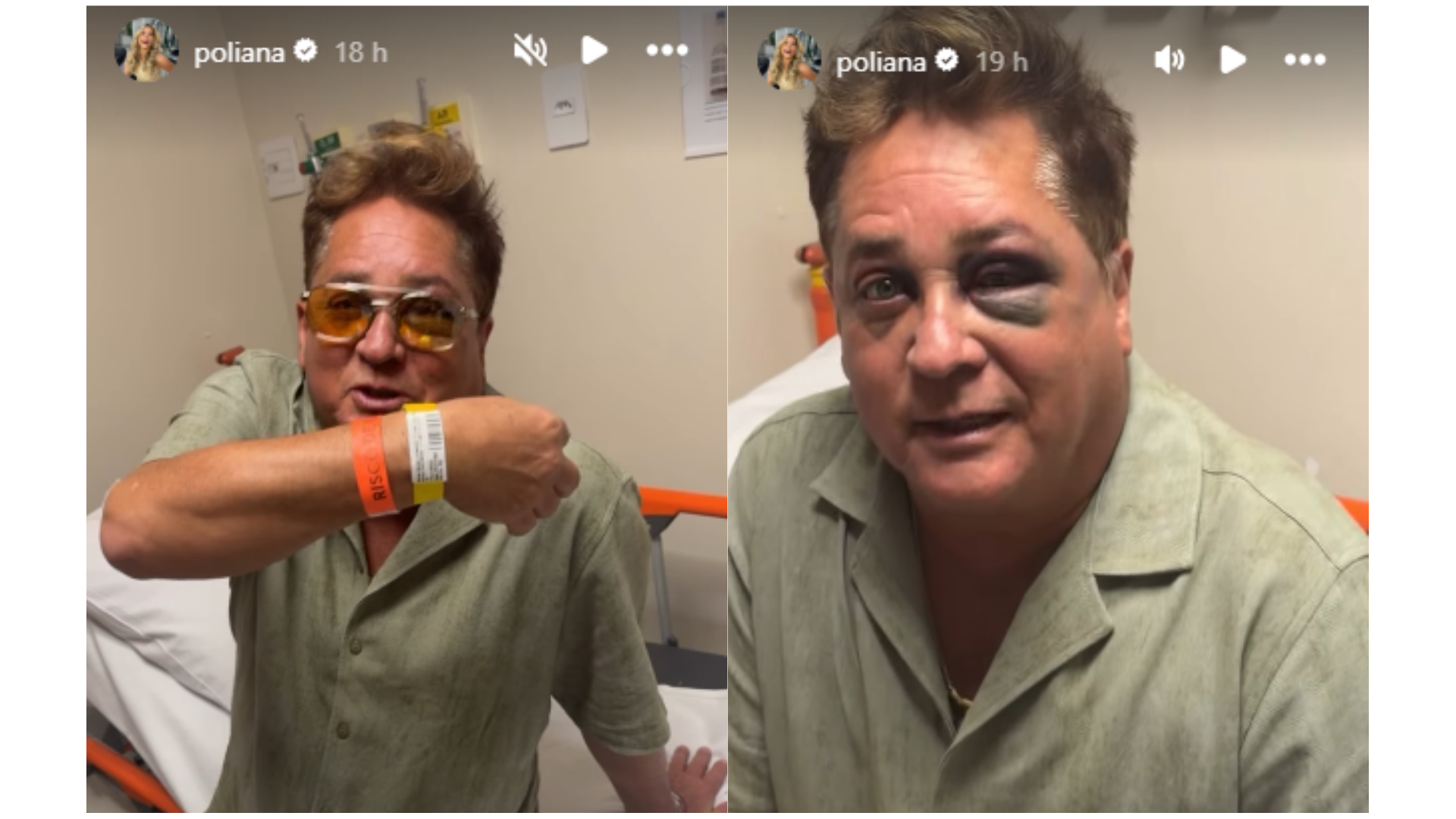 Após acidente Leonardo vai parar no hospital com olho roxo