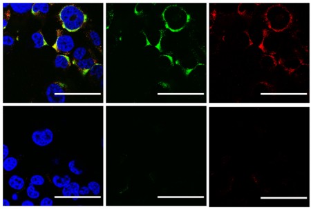 influenza A e da COVID-19