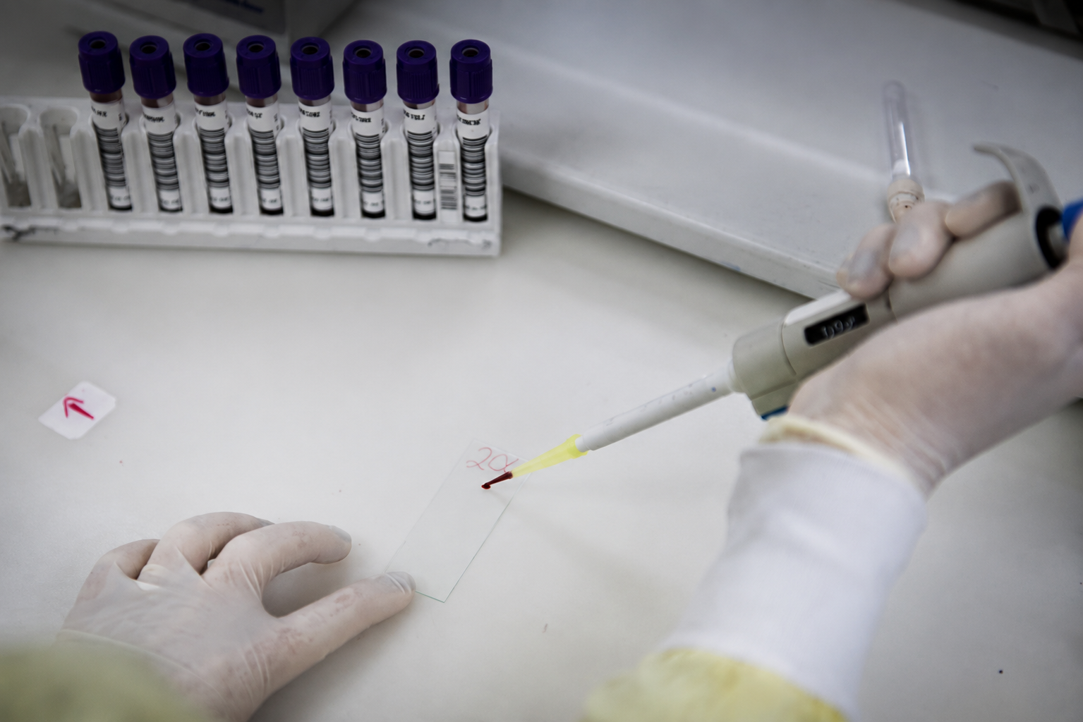 Casos suspeitos de ebola em São Paulo e no Rio mobiliza autoridades; veja o que se sabe