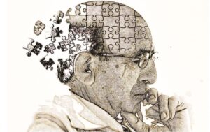 Pela primeira vez, terapias capazes de modificar o curso do Alzheimer estão disponíveis, afirma neurologista Bruce Miller. Exames de sangue detectam proteínas até 20 anos antes dos sintomas.