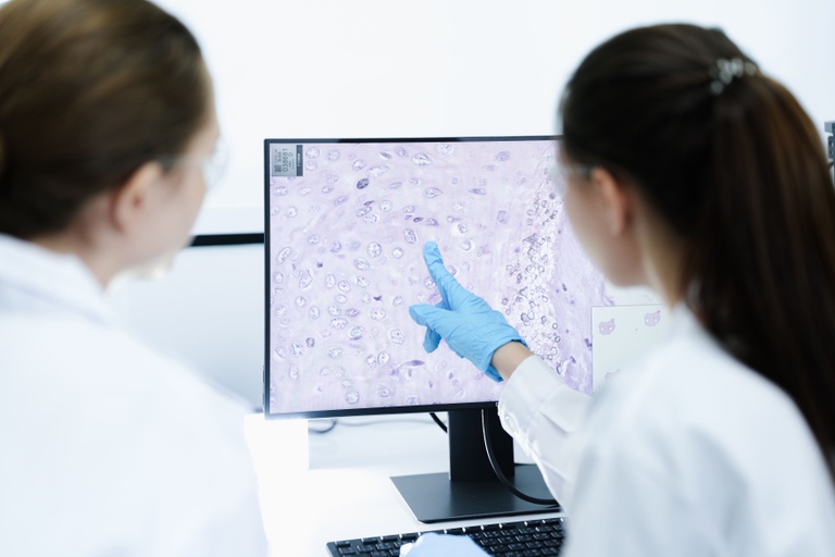 linfoma anvisa