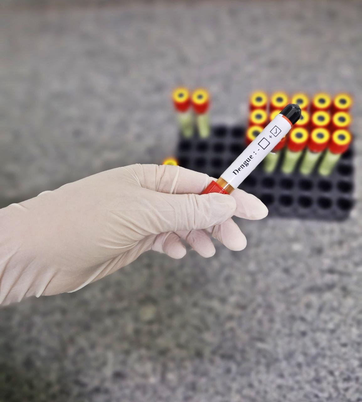 Dengue cuidados