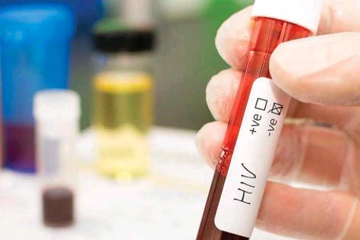 América Latina é excluída de acordos para genéricos do HIV pela terceira vez; SUS segura avanços no Brasil
