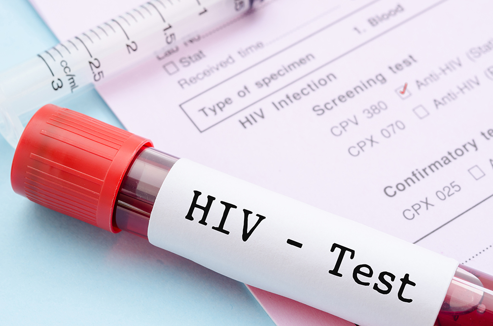 Fiocruz conclui tecnologia para fabricar no Brasil principal medicamento contra HIV usado no SUS