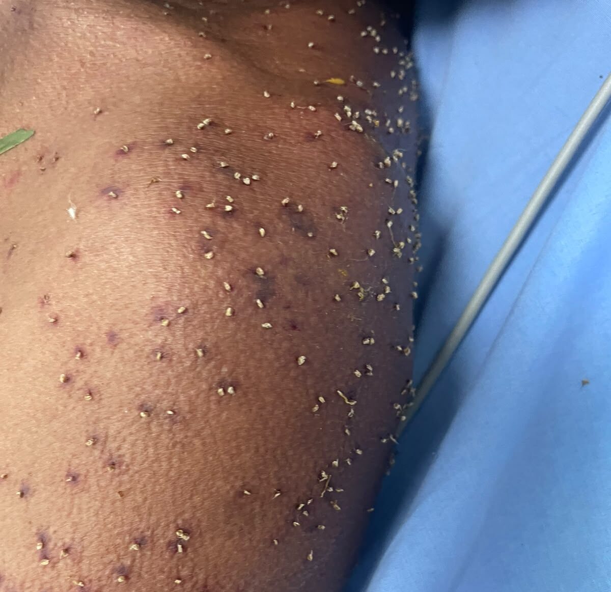 Homem fica inconsciente após ser atacado por enxame de abelhas em Itapuranga